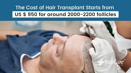 Cost of Hair Transplant in India